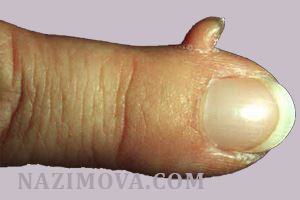 usl-laser-kojniy-rog1.jpg usl-laser-kojniy-rog1.jpg