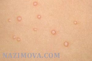 usl-laser-mollusk.jpg usl-laser-mollusk.jpg