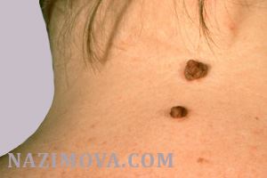 usl-laser-rodinka2.jpg usl-laser-rodinka2.jpg